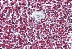 Lgr6 Antibody, Novus Biologicals 50 &mu;g | Buy Online | Novus Biologicals | Fisher Scientific